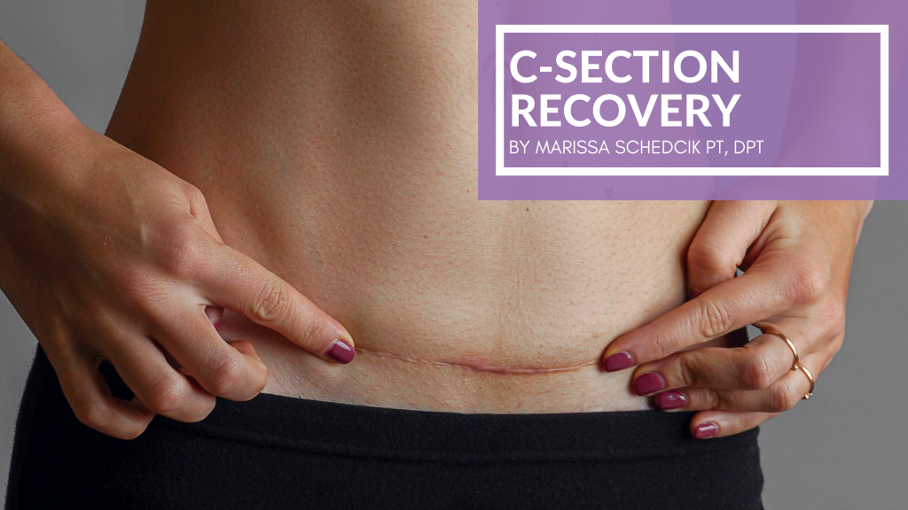 c-section recovery blog post cover image